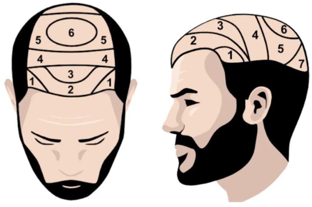 Scalp Diagram